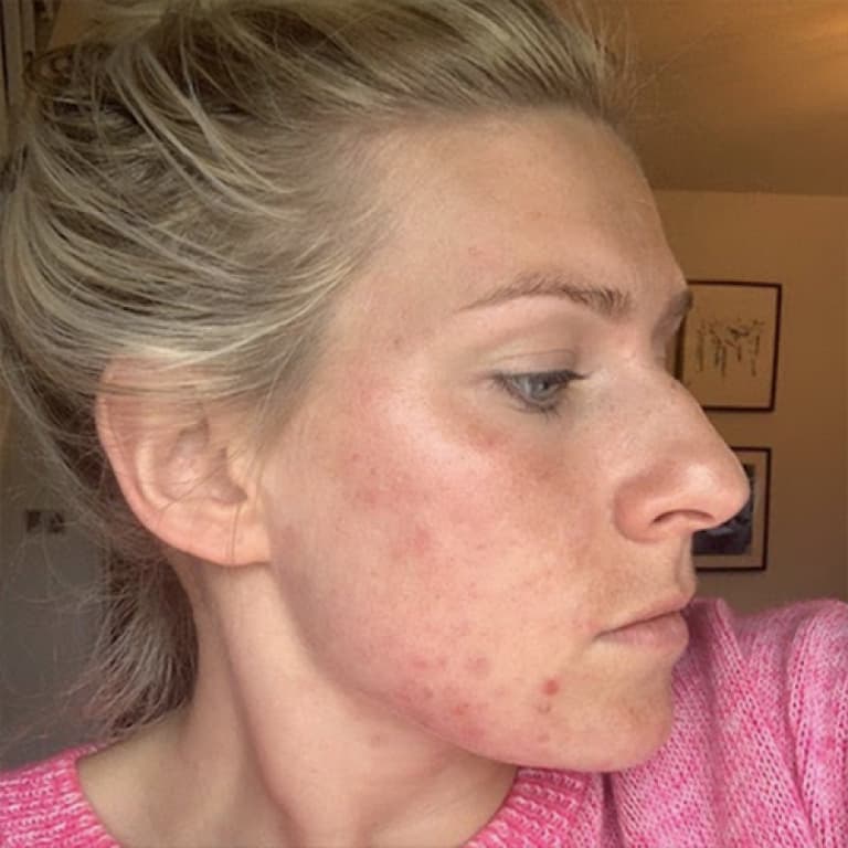 skin me
