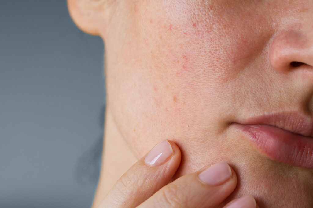 Berberine powder supplier Berberine powder supplier