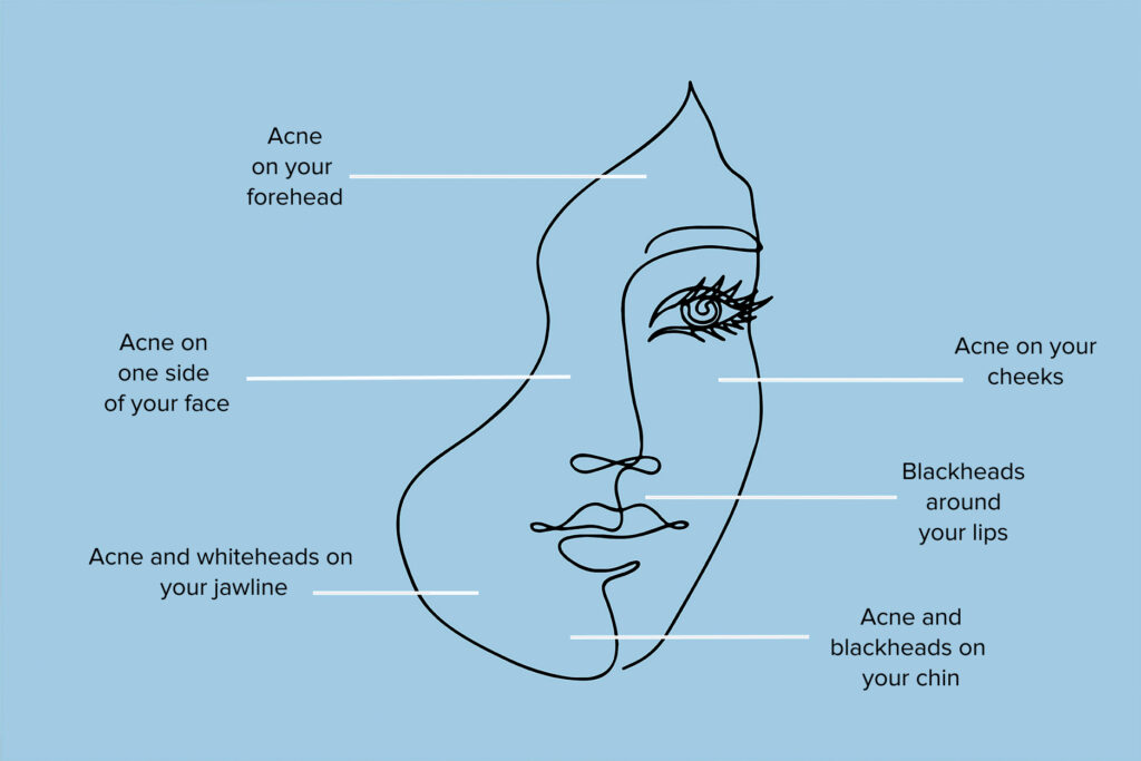 From your forehead to chin - what your SPOTS reveal about your