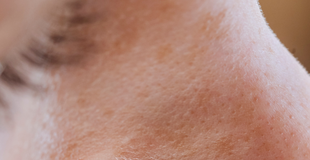 close up image of a woman's pores over nose and cheeks