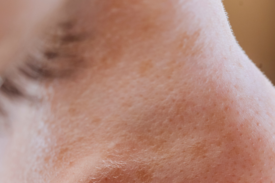 close up image of a woman's pores over nose and cheeks